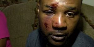 Two former officers indicted for beating a black man